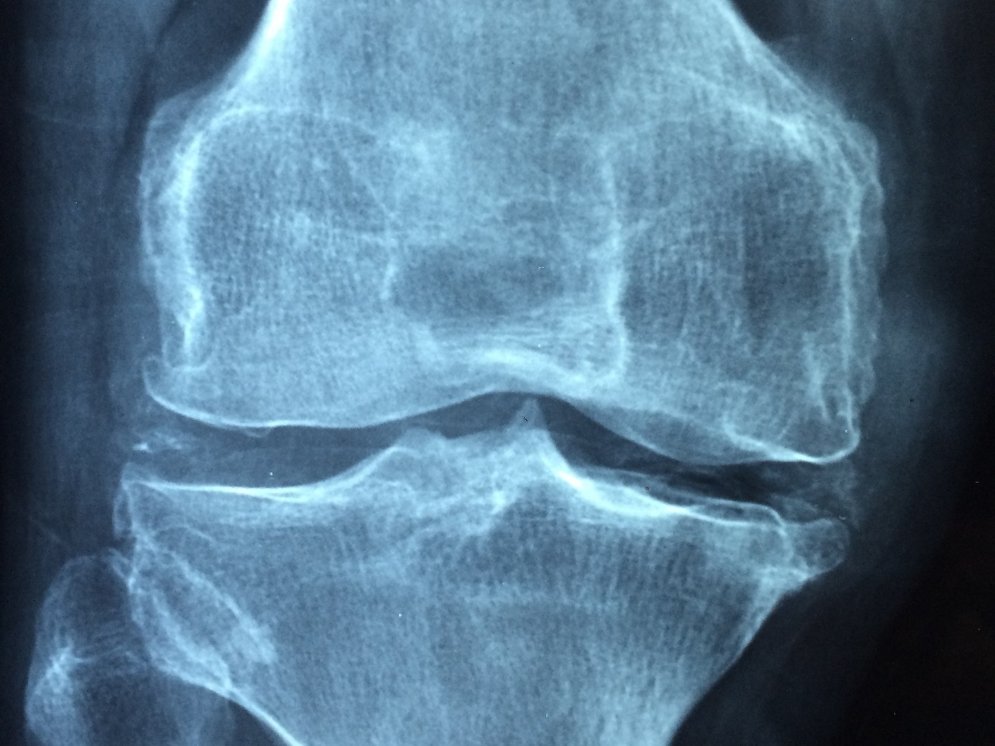 WL_Gelenk © Pixabay