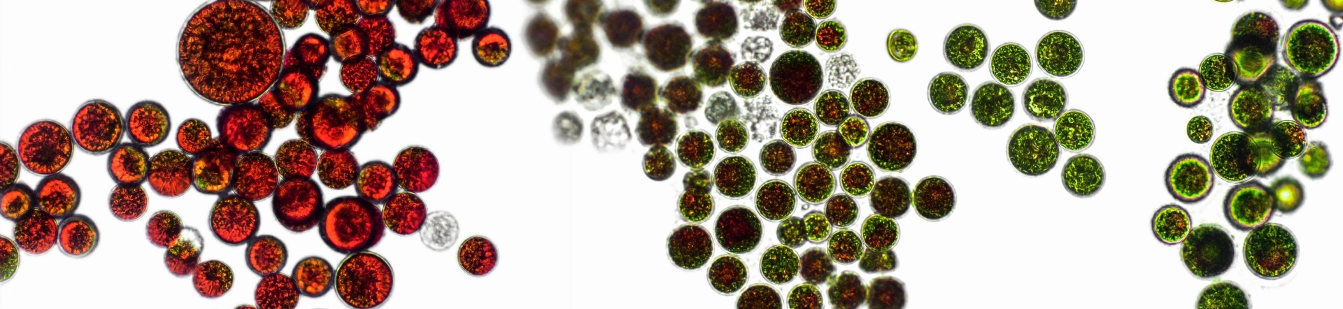 Mikroskopische Aufnahme der einzelligen Blutregenalge (Haematococcus pluvialis) mit intensivroter und dunkelgrüner Färbung.