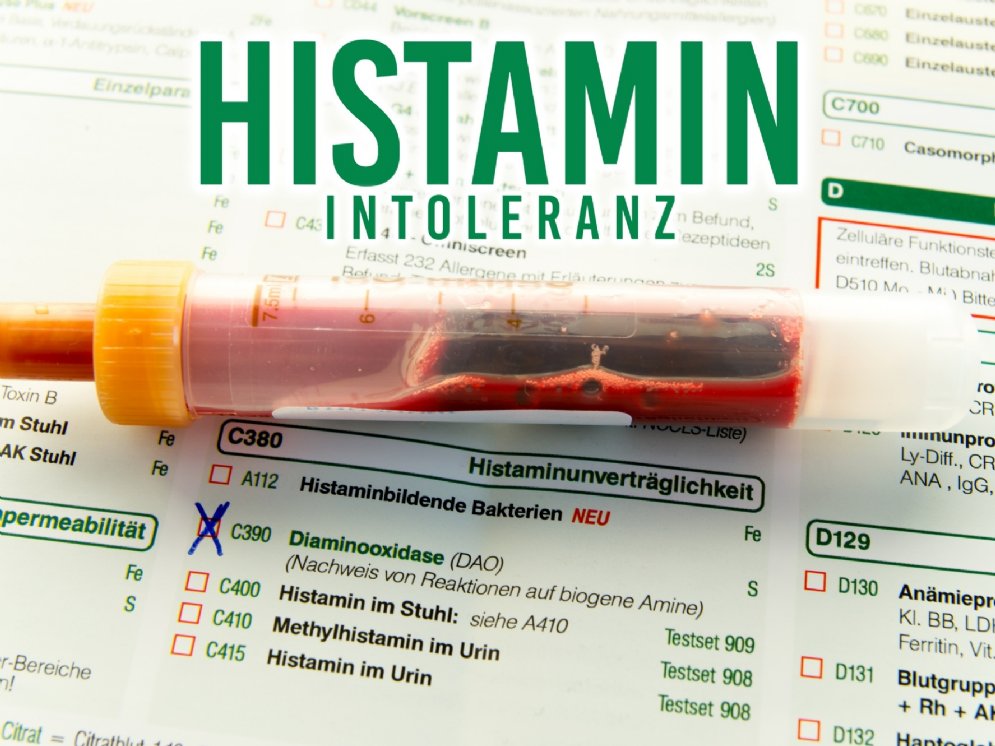 Histamin Intoleranz Blutprobe Diaminoxidase © Adobe Stock